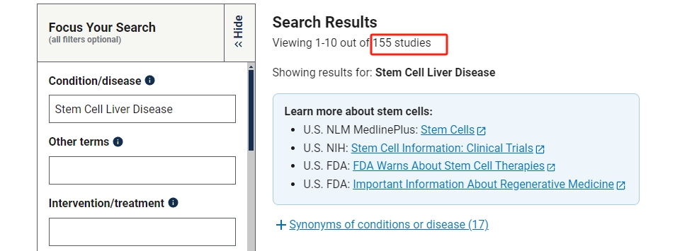 干細胞治療肝病的臨床研究進展