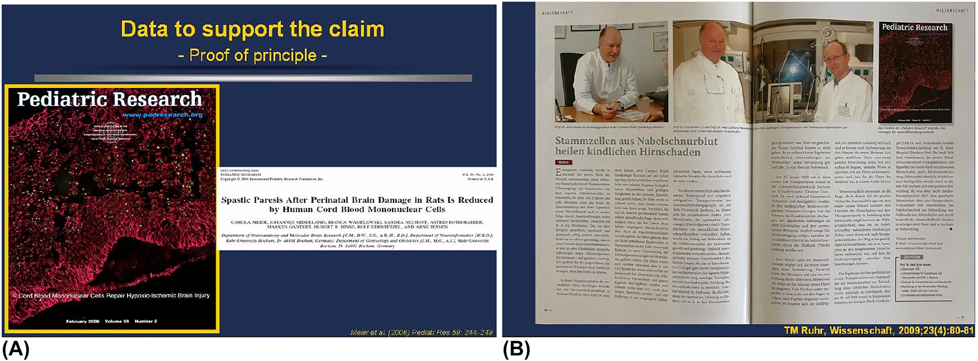 圖7：首次通過實驗和臨床證明臍帶血MNC可潛在治愈腦性癱瘓。