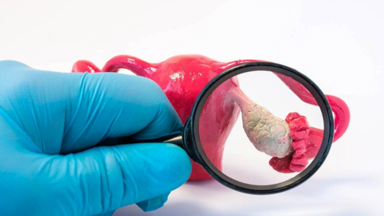 干細胞治療卵巢早衰的流程