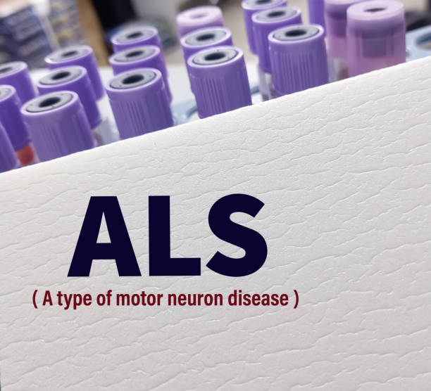 干細(xì)胞治療漸凍癥：78例患者的安全性與有效性驗(yàn)證