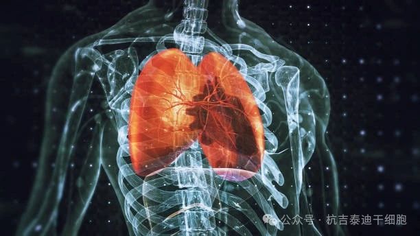 干細(xì)胞療法與呼吸系統(tǒng)