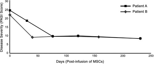 圖 1?. 移植 MSCs 前后兩例患者的銀屑病面積和嚴(yán)重程度指數(shù) (PASI) 評(píng)分總結(jié)。在輸注 MSCs 后的隨訪中，每例患者的 PASI 評(píng)分均有所下降。評(píng)分由第三方皮膚科醫(yī)生進(jìn)行。臨床改善持久，患者 A 的改善持續(xù)超過(guò) 150 天，患者 B 的改善持續(xù)超過(guò) 200 天。