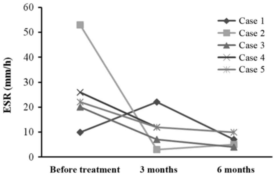 每位患者治療前后的 CRP 水平。1 名患者的 CRP 水平降低，而其他 4 名患者的 CRP 水平保持穩(wěn)定并在正常范圍內(nèi)。CRP，C 反應(yīng)蛋白。