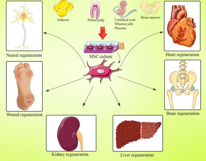 間充質干細胞(MSC) 是一種多能細胞，可分化為基質譜系細胞。間充質干細胞(MSC) 是骨髓 (BM-MSC)、脂肪組織、肝臟、羊水、胚胎胎盤、臍帶血和其他組織中的一組非造血細胞。骨髓間充質干細胞能夠抑制與GVHD病理生理學有關的大多數免疫細胞的激活和功能。