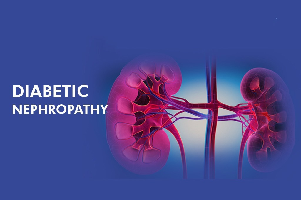 干細(xì)胞治療糖尿病腎病患者16例，能夠有效控制血糖，改善腎功能