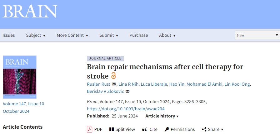 確認干細胞治療中風后的大腦修復機制,以推動干細胞治療中風進入臨床至關重要! 確認干細胞治療中風后的大腦修復機制,以推動干細胞治療中風進入臨床至關重要!