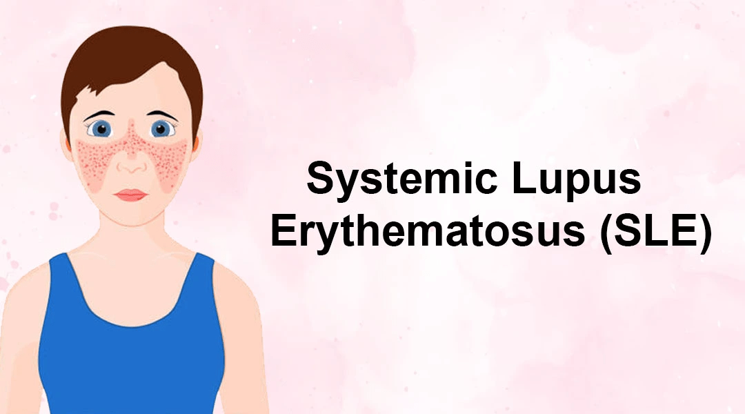 間充質干細胞治療系統性紅斑狼瘡3大作用機制，你都了解嗎？