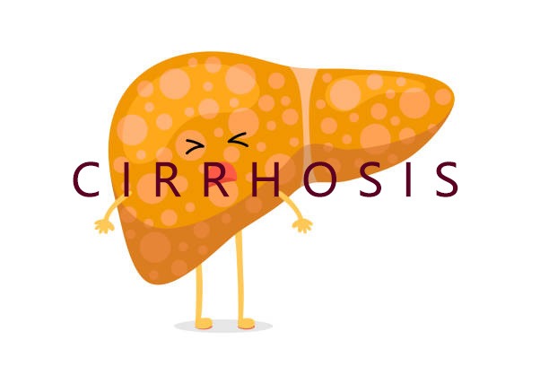 2020-2024年干細(xì)胞治療肝硬化的臨床研究進(jìn)展 2020-2024年干細(xì)胞治療肝硬化的臨床研究進(jìn)展