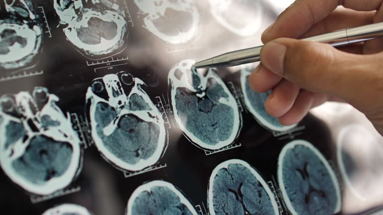 事關(guān)神經(jīng)退行性疾病，干細胞在治療神經(jīng)退行性疾病的療效、倫理、安全等問題的綜述