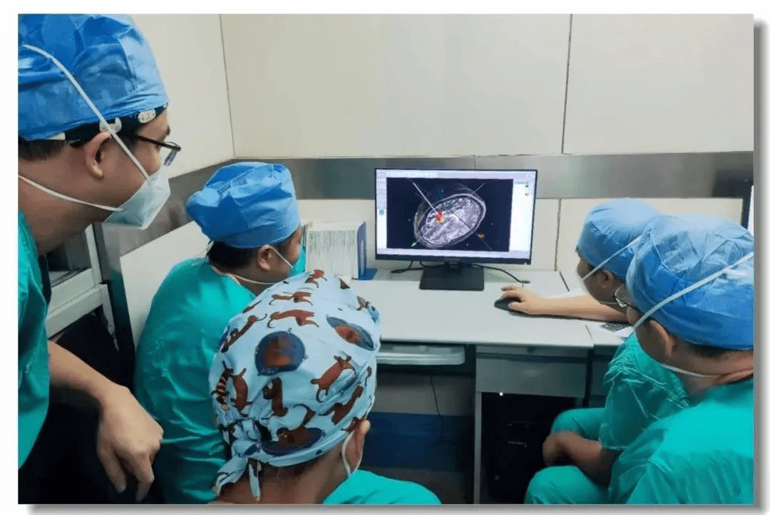 立體定向引導下神經干細胞移植術