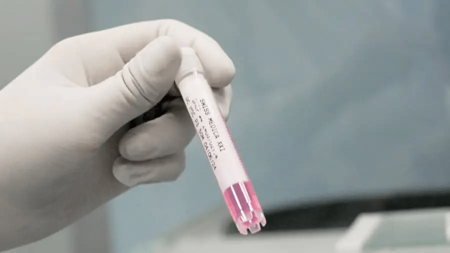 干細胞治療程序：??完整流程和所有步驟！