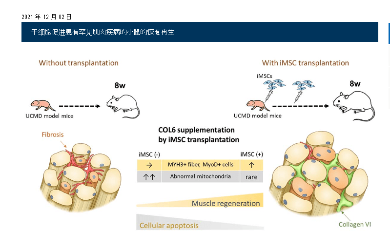 2021年干細(xì)胞治療肌肉萎縮癥臨床案例 2021年干細(xì)胞治療肌肉萎縮癥臨床案例