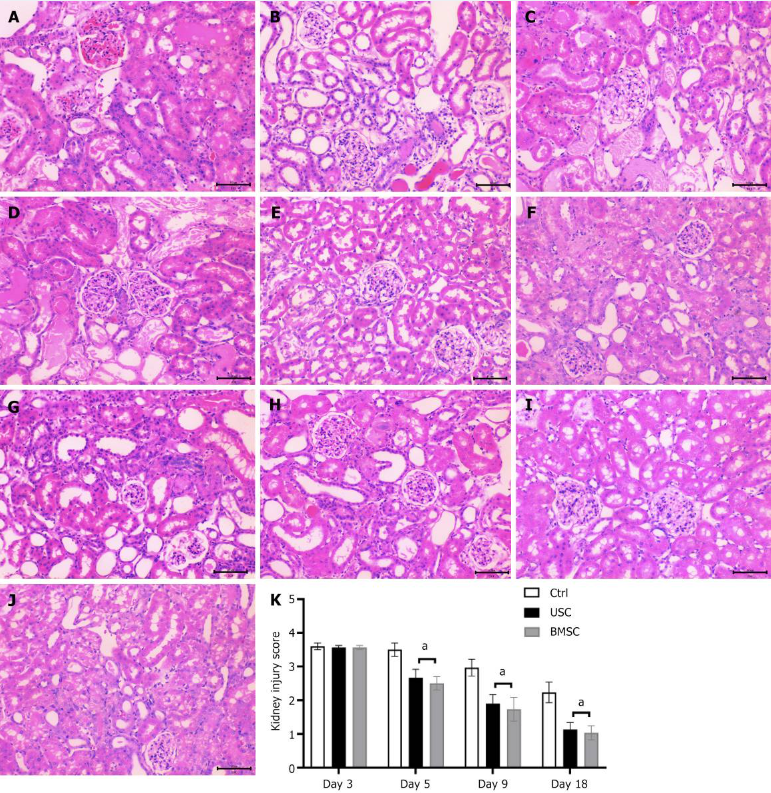 圖4：通過蘇木精和伊紅染色（200 ×）對(duì)尿液來(lái)源的干細(xì)胞治療、骨髓間充質(zhì)干細(xì)胞治療和對(duì)照未治療小鼠的急性腎損傷進(jìn)行組織學(xué)檢查。