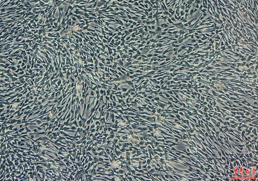 羊膜間充質干細胞