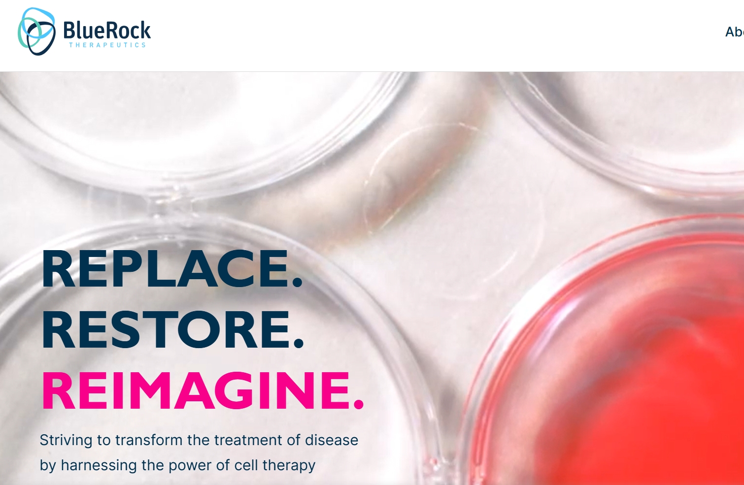 拜耳突破性干細胞治療帕金森病III期臨床試驗啟動,開啟治療新紀元! 拜耳突破性干細胞治療帕金森病III期臨床試驗啟動,開啟治療新紀元!