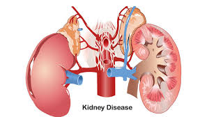 減輕負擔,延長生命:干細胞療法對降低腎病透析并發(fā)癥的影響評估