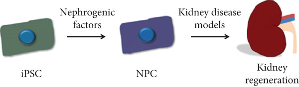 腎臟疾病中的 iPSC 衍生腎細胞