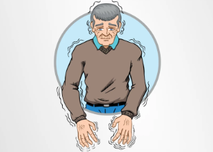 從短期緩解到長期穩(wěn)定:干細胞移植治療帕金森病的療效持續(xù)時間研究 從短期緩解到長期穩(wěn)定:干細胞移植治療帕金森病的療效持續(xù)時間研究