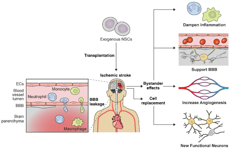 圖2：NSC輸送示意圖，說明缺血性中風的多種治療機制。