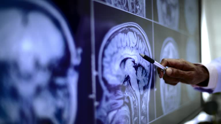 綜述：談談間充質干細胞治療中風的機制、案例及未來發展方向