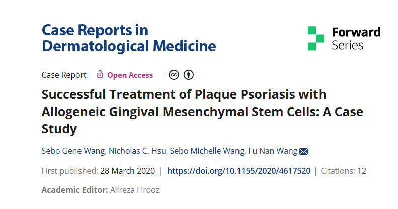 同種異體牙齦間充質干細胞成功治療斑塊性銀屑病:案例研究 同種異體牙齦間充質干細胞成功治療斑塊性銀屑病:案例研究