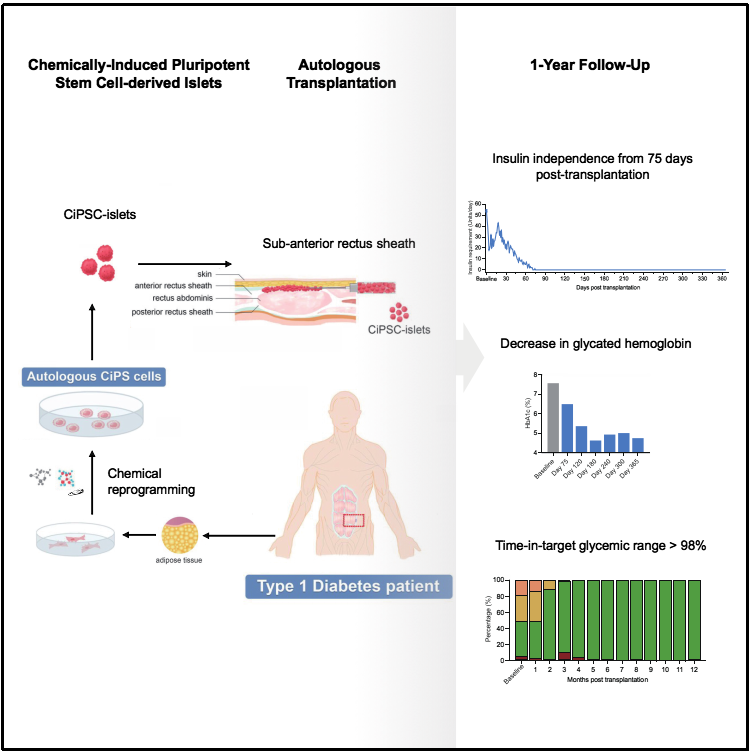 圖1:基于CiPS細胞治療1型糖尿病的臨床研究的示意圖和治療效果