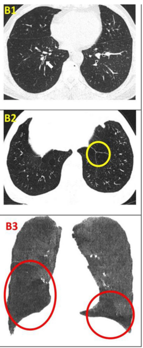 影像學(xué)檢查 影像學(xué)檢查