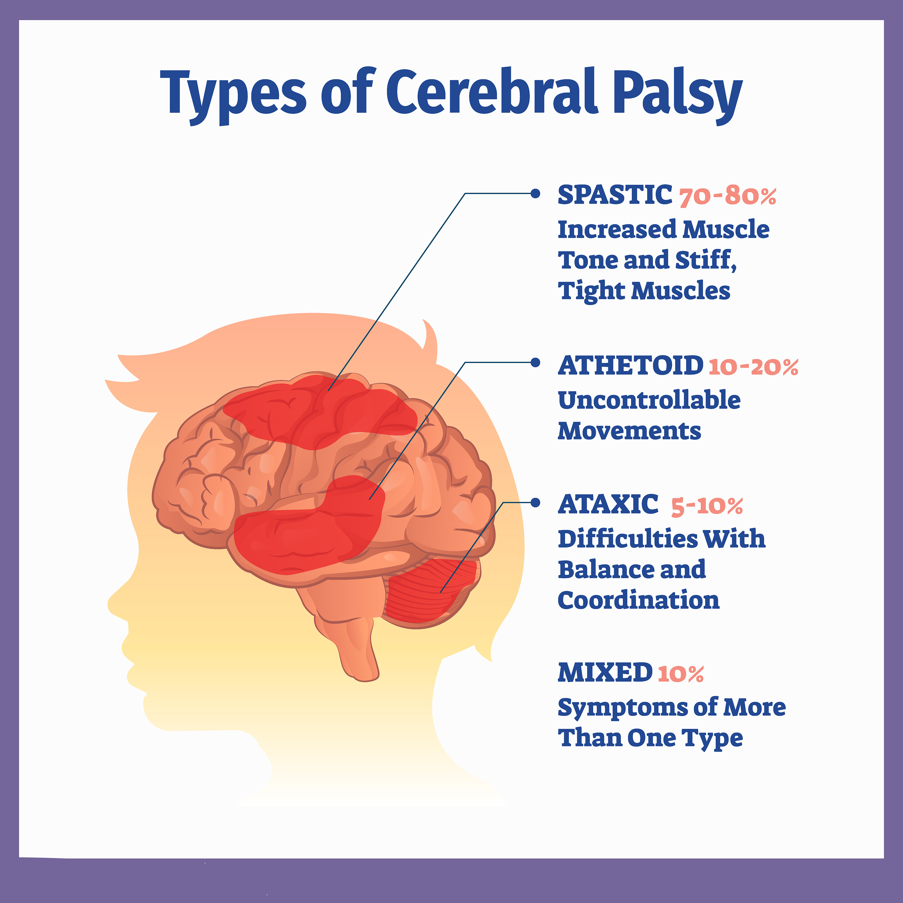 低劑量VS高劑量：不同劑量的干細(xì)胞治療腦癱哪個(gè)更加安全？