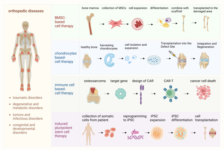 圖1:骨科疾病細胞療法的詳細流程。該圖概述了用于治療骨科疾病的各種細胞療法所涉及的逐步流程。 圖1:骨科疾病細胞療法的詳細流程。該圖概述了用于治療骨科疾病的各種細胞療法所涉及的逐步流程。