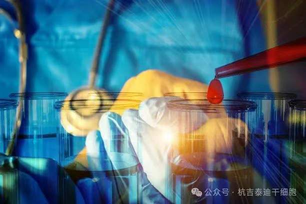 一名RA/MS患者經(jīng)過CAR-T治療失敗后，經(jīng)過自體干細(xì)胞移植后，主觀健康狀態(tài)顯著改善！