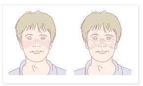 2025年1-12月干細胞治療系統性紅斑狼瘡匯總：多項臨床試驗全面提速！