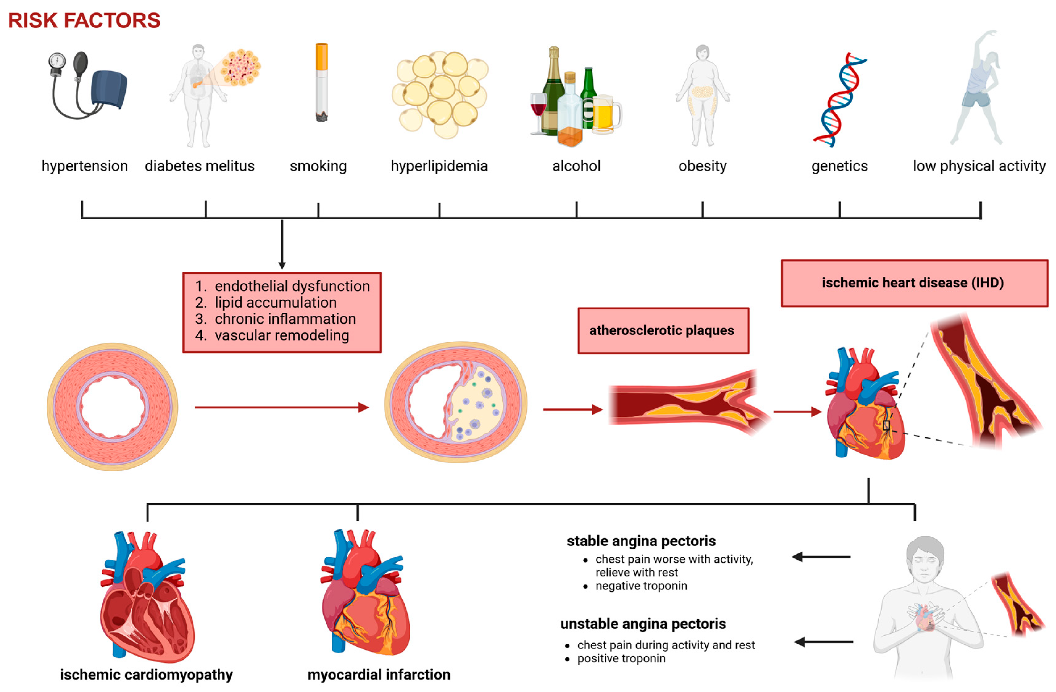 圖1:冠狀動(dòng)脈疾病和缺血性心臟病的病理生理學(xué)。 圖1:冠狀動(dòng)脈疾病和缺血性心臟病的病理生理學(xué)。