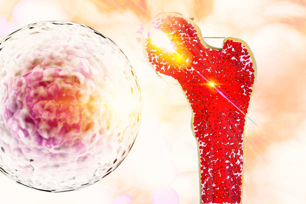 干細胞移植對捐獻者身體有害嗎?2025年醫學真相大揭秘(附捐獻者自述) 干細胞移植對捐獻者身體有害嗎?2025年醫學真相大揭秘(附捐獻者自述)