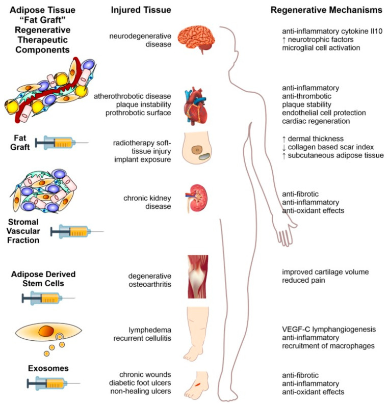 圖2：本文以示意圖形式概述了利用脂肪組織脂肪治療人類疾病的方法。