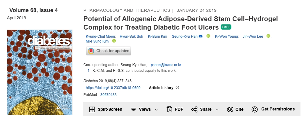 同種異體脂肪干細胞-水凝膠復合物治療糖尿病足潰瘍的潛力 同種異體脂肪干細胞-水凝膠復合物治療糖尿病足潰瘍的潛力