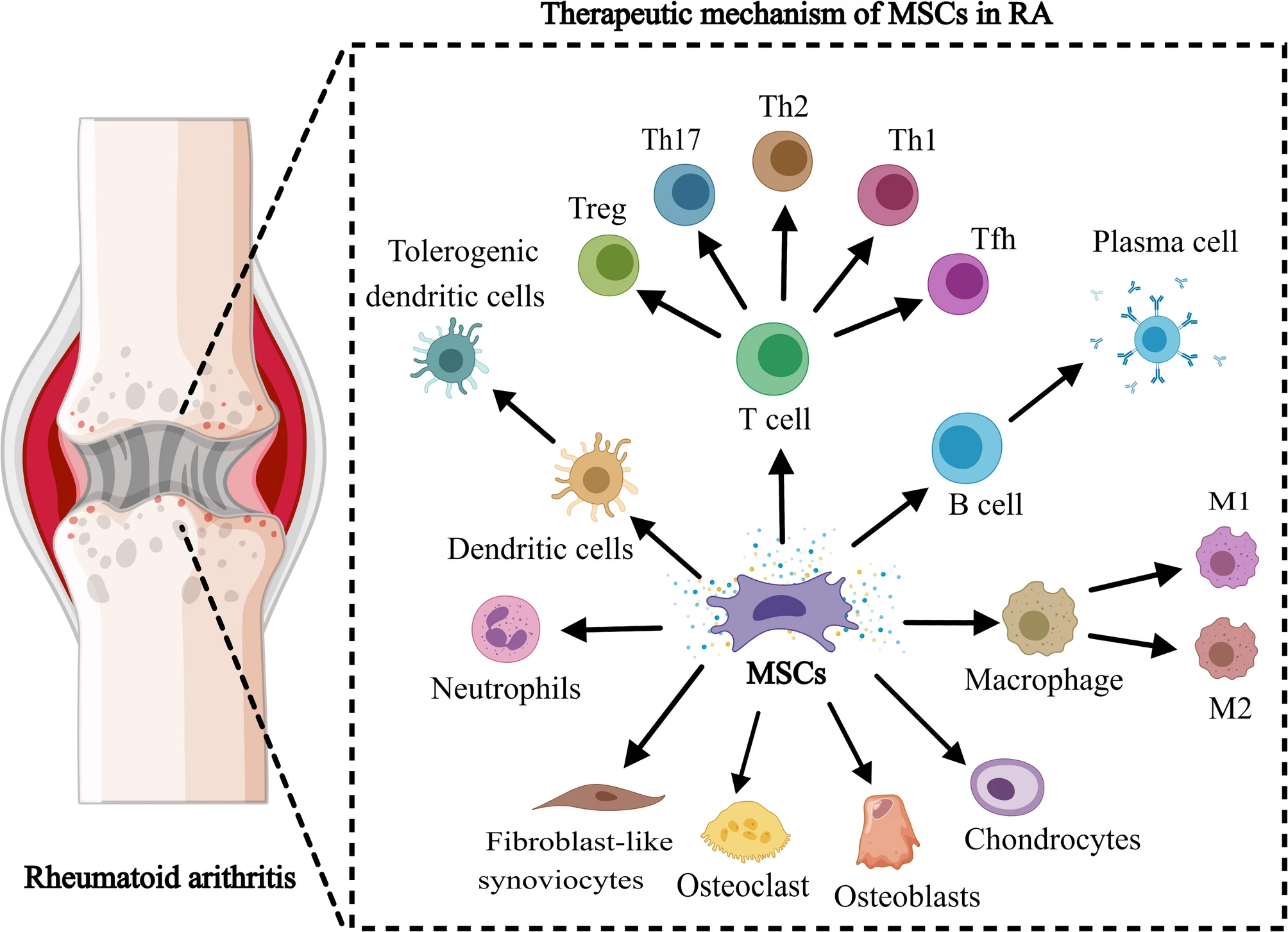 圖3：間充質干細胞在治療類風濕性關節炎中的機制。