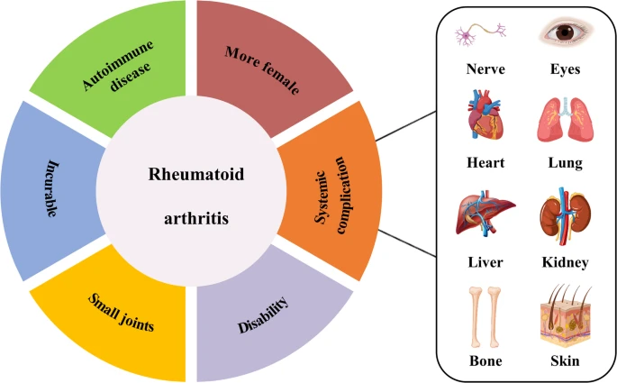 圖1：類風濕性關節炎的一般特征。