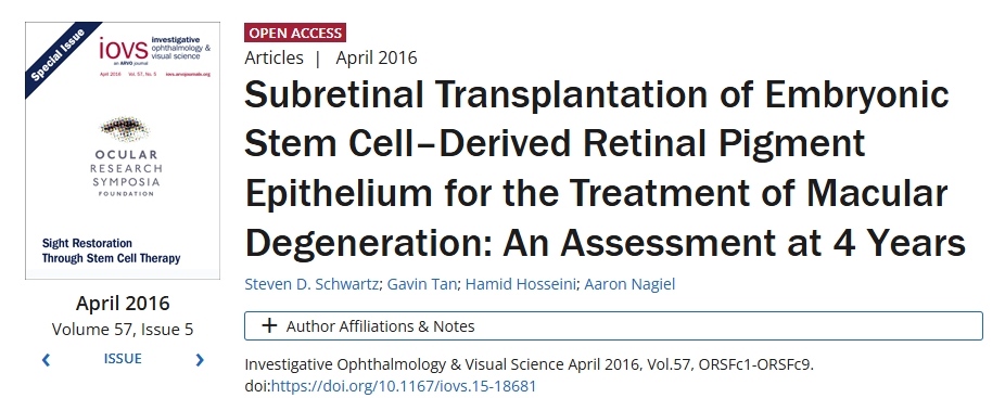 胚胎干細胞來源的視網(wǎng)膜色素上皮視網(wǎng)膜下移植治療黃斑變性：4年評估