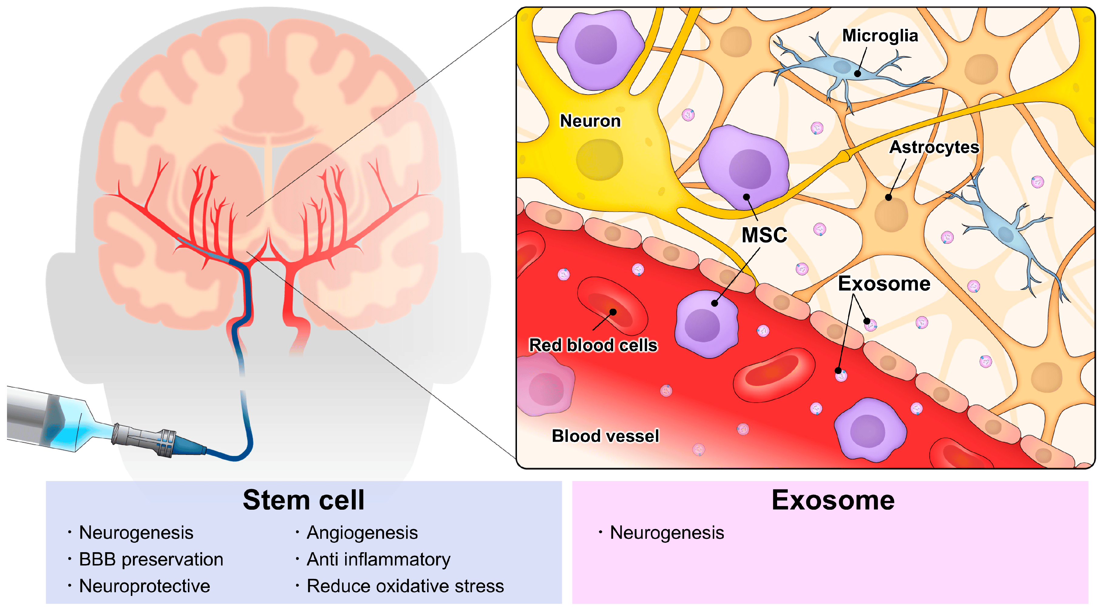 動脈注射干細胞&外泌體治療神經系統疾病，打多少細胞好？