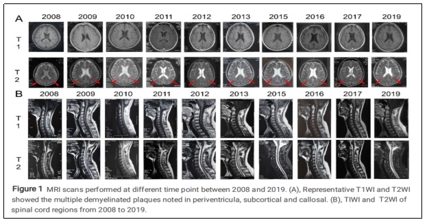 臨床試驗(yàn) 臨床試驗(yàn)