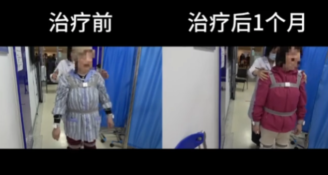 沈女士康復(fù)過程