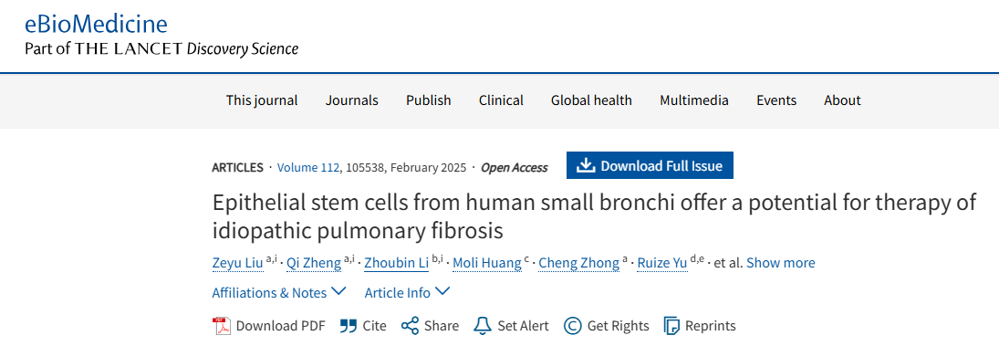 人類小支氣管上皮干細(xì)胞為治療特發(fā)性肺纖維化提供了潛力