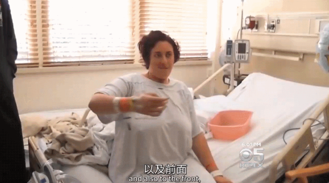 干細(xì)胞治療后