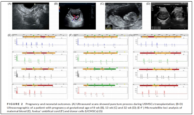 圖2：妊娠和新生兒結果。