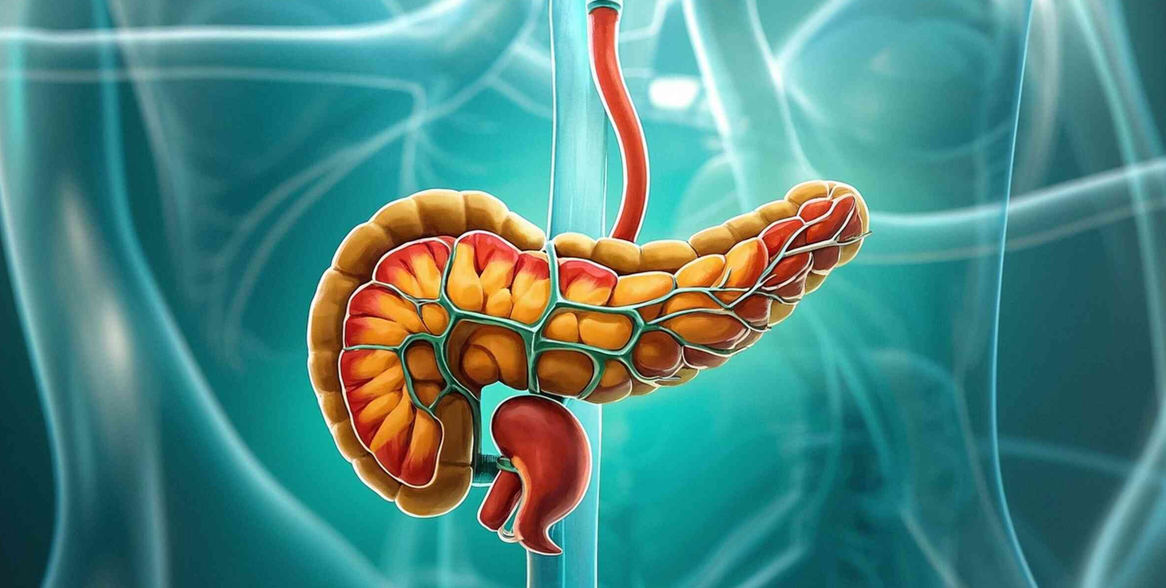 系統性保護!間充質干細胞療法為重癥胰腺炎帶來新曙光 系統性保護!間充質干細胞療法為重癥胰腺炎帶來新曙光