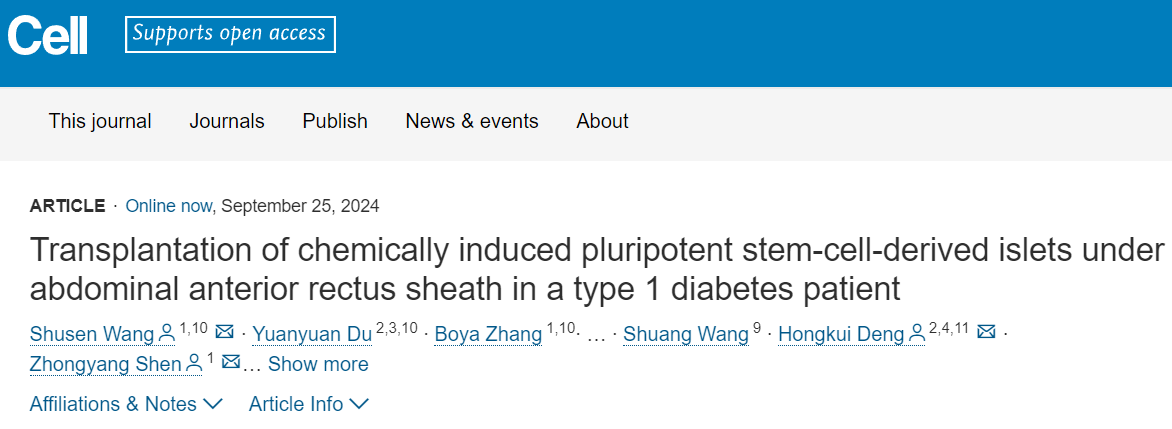 在一名1型糖尿病患者腹部前直肌鞘下移植化學誘導的多能干細胞來源胰島 在一名1型糖尿病患者腹部前直肌鞘下移植化學誘導的多能干細胞來源胰島