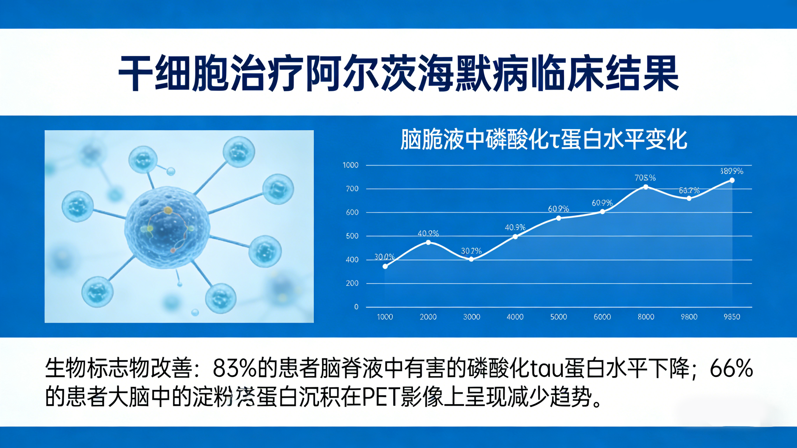 干細胞治療阿爾茨海默病臨床結果 干細胞治療阿爾茨海默病臨床結果
