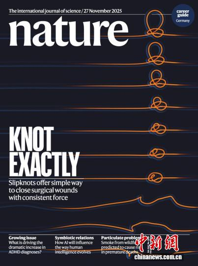 研究成果發(fā)表于國際頂級期刊《自然》并登上雜志封面。研究團(tuán)隊供圖