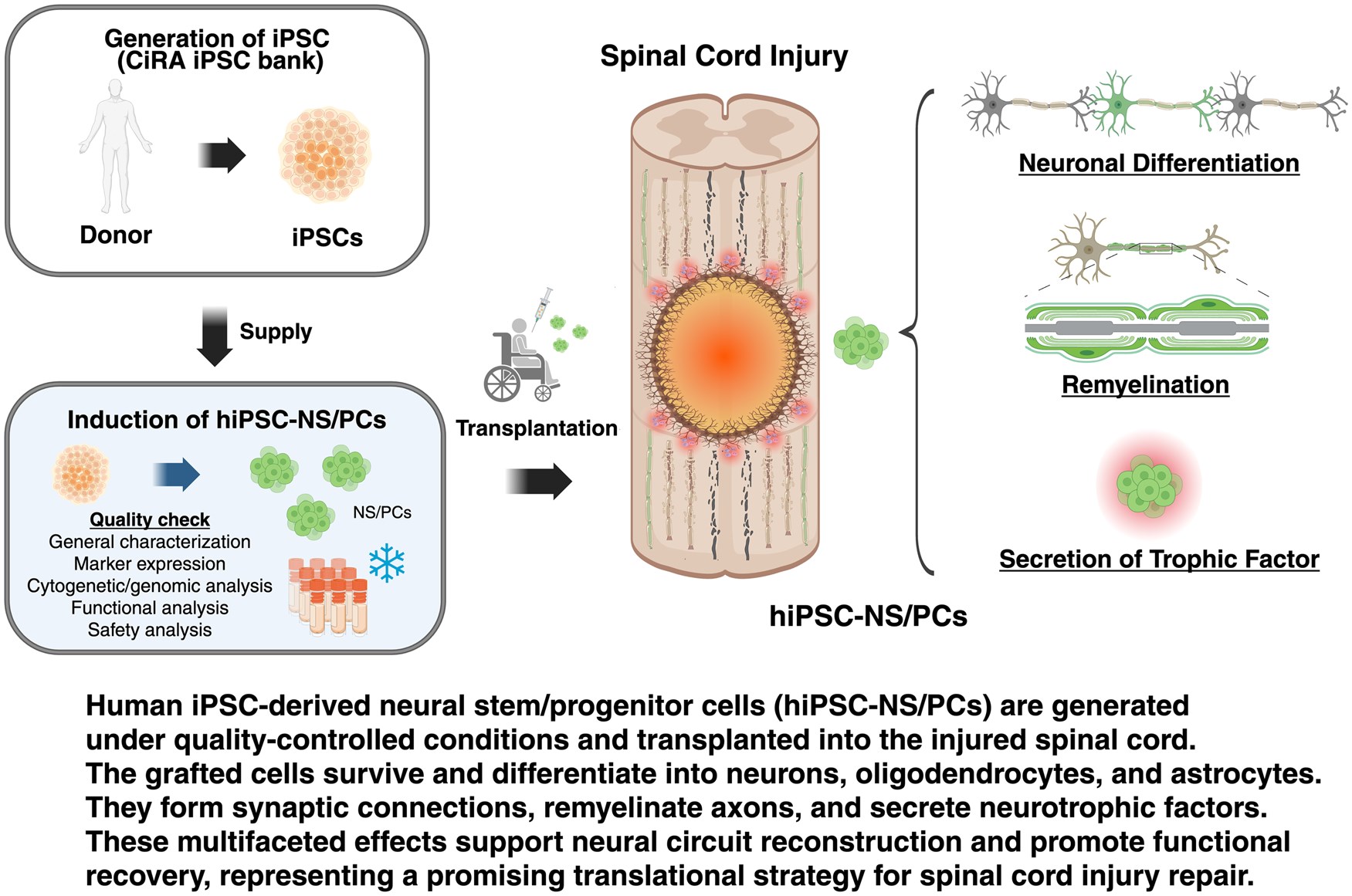 最新綜述！多能干細胞來源的神經干/祖細胞療法治療脊髓損傷：臨床進展和轉化展望