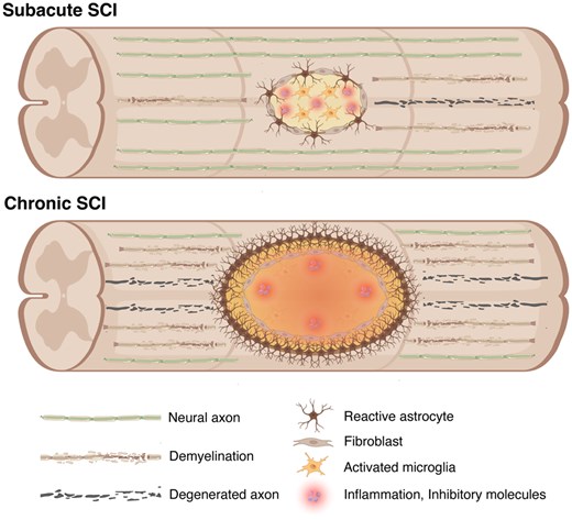 圖2：脊髓損傷后亞急性期和慢性期的病理特征。